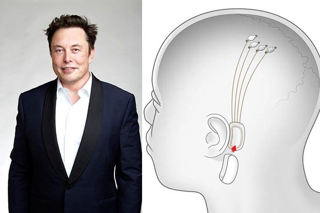 Neuralink, Elon Musk’s brain implant startup, raises $280 millions